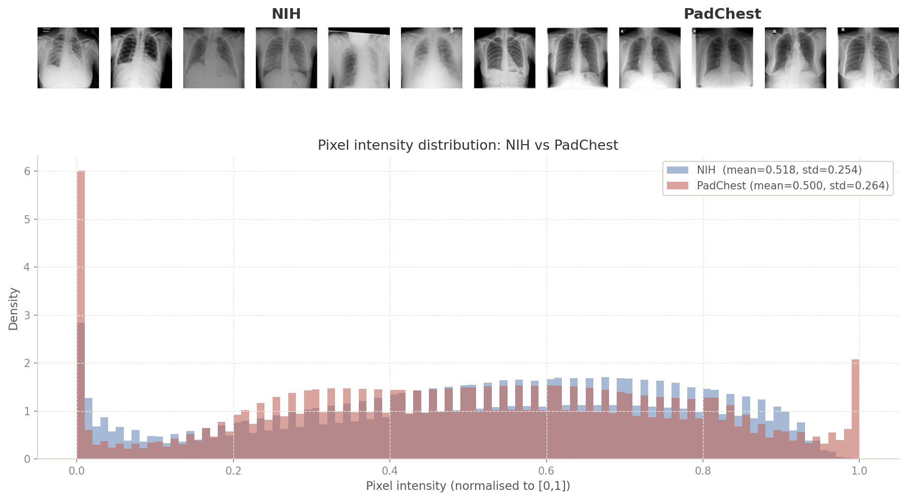 NIH vs PadChest pixel distribution, sample images top row, histogram bottom