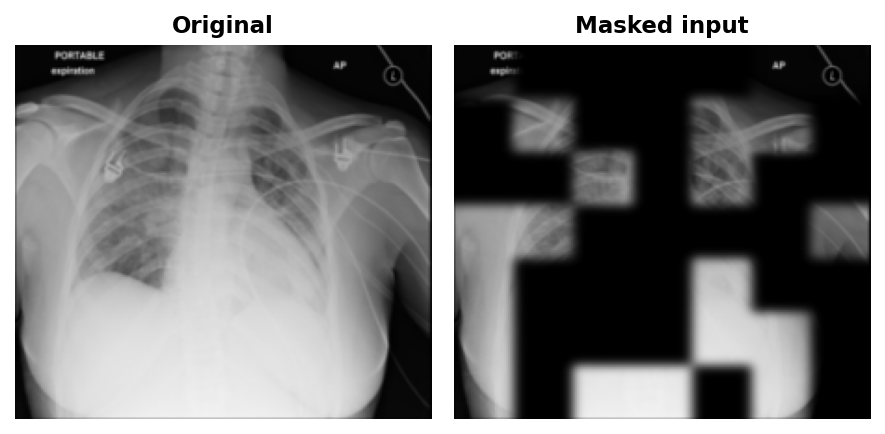 The same chest X-ray before and after masking: 60% of 32x32 patches zeroed out