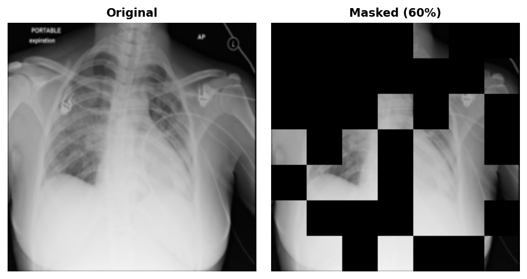 Original chest X-ray beside the same image with 60% of 32x32 patches zeroed out